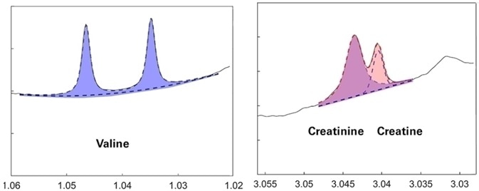 Bruker IVDr platform