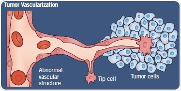 Normal angiogenesis versus tumor vascularization