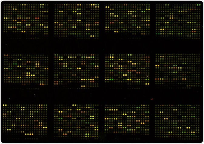 Microarrays have provided unprecedented benefits for researchers for many years, but are now being superseded by nanoarrays,