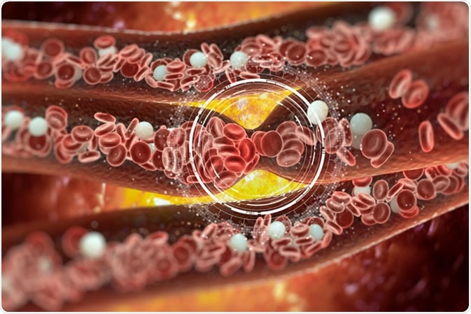 Blood Clotting Illustration. Credit: Vitstudio / Shutterstock