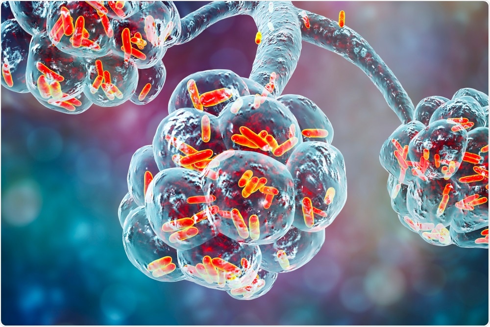 bacterial lung infection