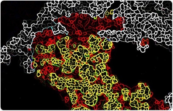Cancer cells ‘corrupt’ their healthy neighbors to support tumor growth