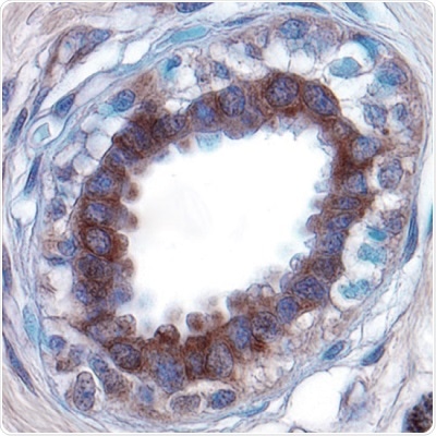 Extracellular Matrix Degradation