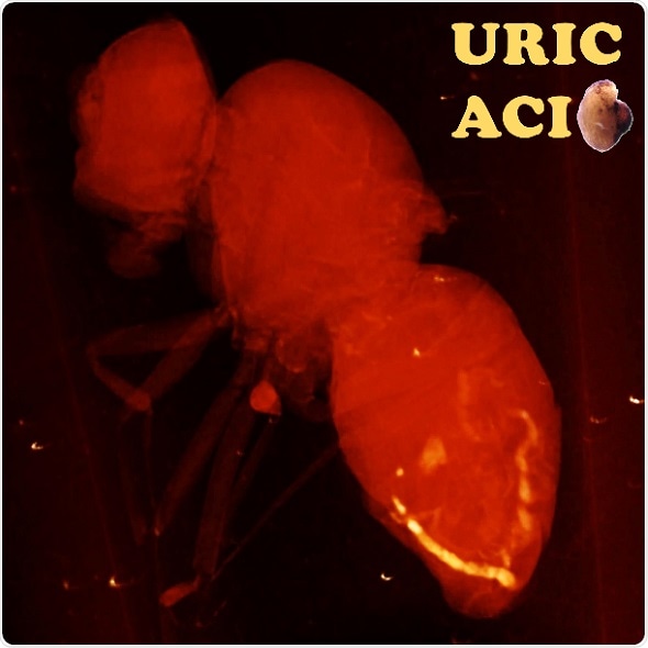 Fruit fly model for studying diseases like gout, kidney stones reveals new drug targets