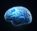 Implantable brain chip could solve obesity epidemic