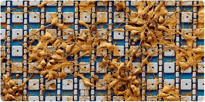 False colored scanning electron microscope image of neurons cultured on top of the electrode array. Actual recording experiments are performed with much higher neuron densities containing three to six cell layers covering the entire electrode array. Image Credit: Harvard SEAS