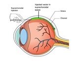 Johns Hopkins researchers develop new way to deliver sight-saving gene therapy to the retina