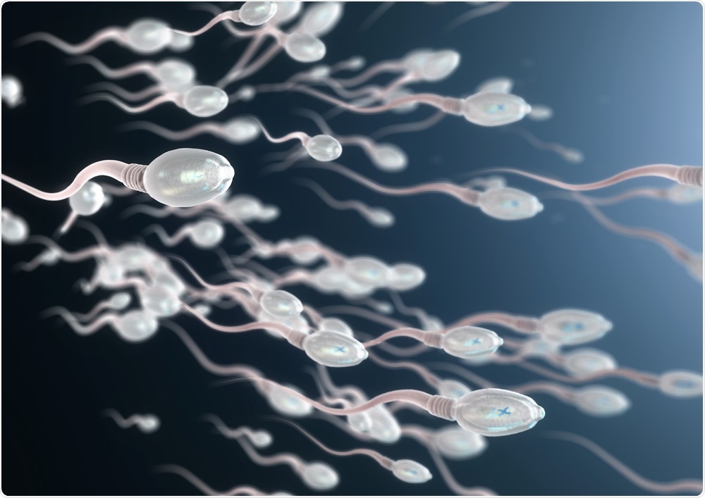 Sperm