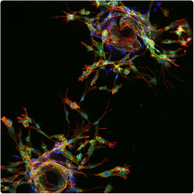 Study provides new insight into unknown effects of factors that regulate blood vessel formation Study provides new insight into unknown effects of factors that regulate blood vessel formation