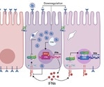 Gut's immune response to SARS-CoV-2 very different from the lung