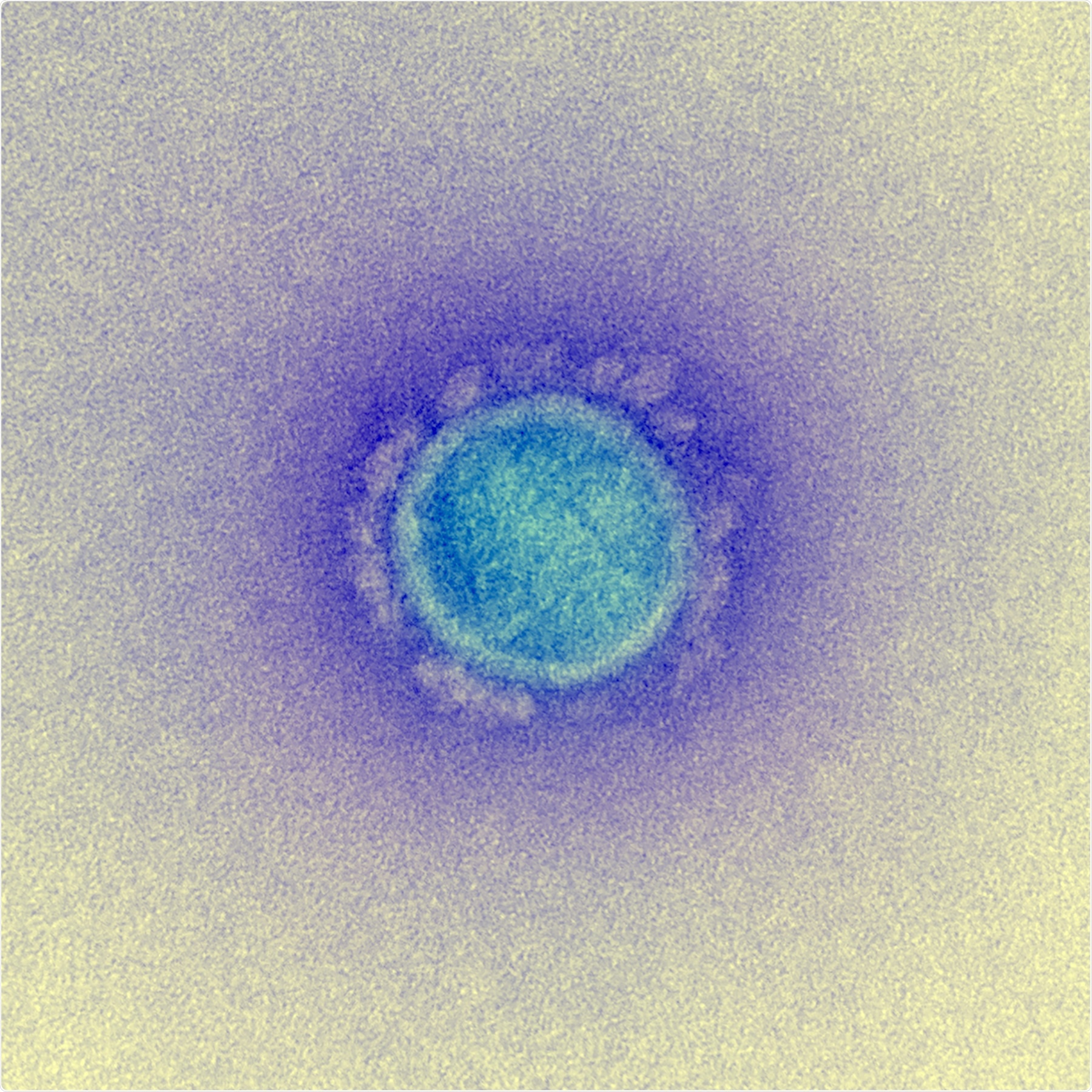 Study: The detection and stability of the SARS-CoV-2 RNA biomarkers in wastewater influent in Helsinki, Finland. Image Credit: NIAID