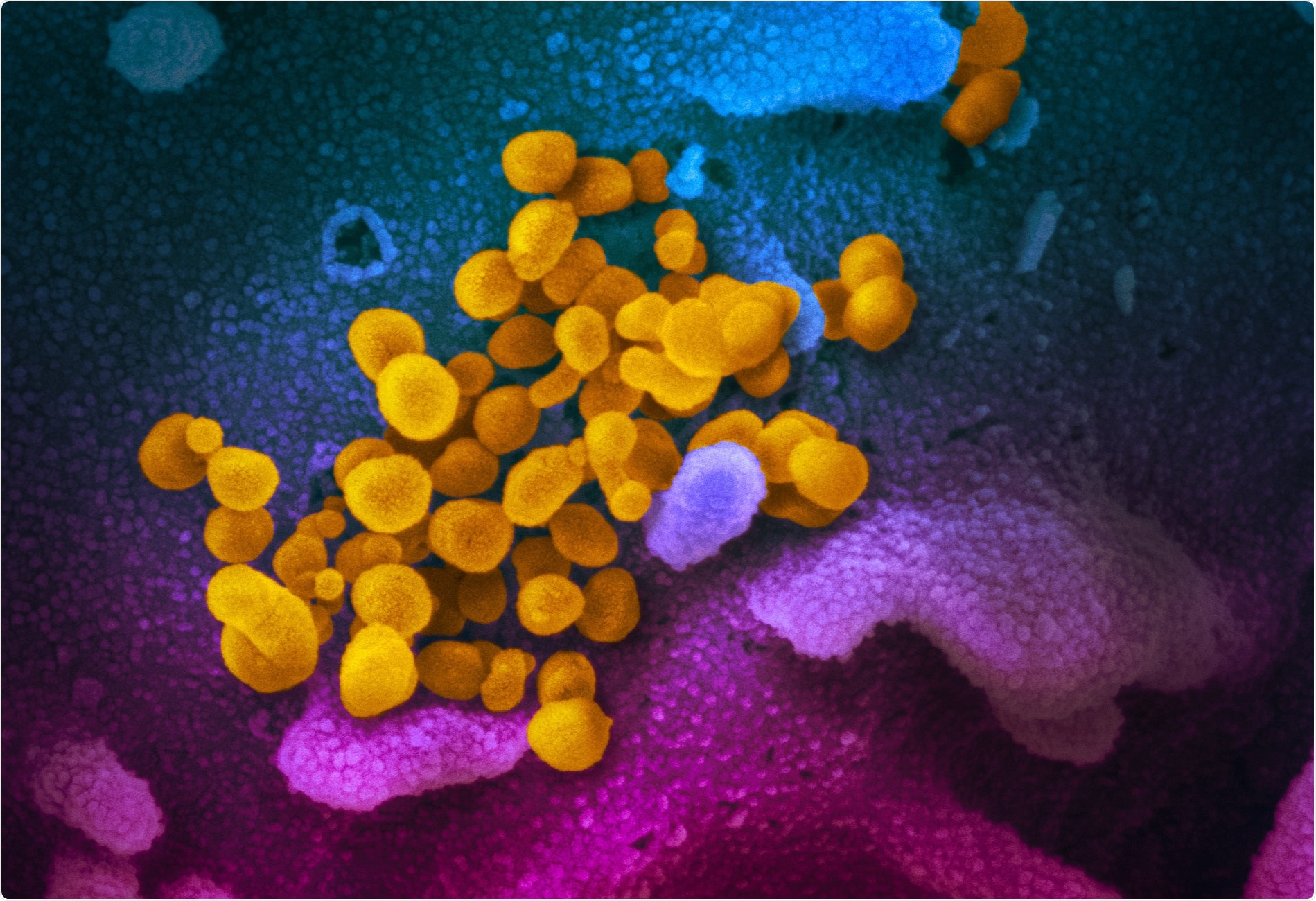 Study: SARS-CoV-2 infection of human ACE2-transgenic mice causes severe lung inflammation and impaired function. Image Credit: NIAID