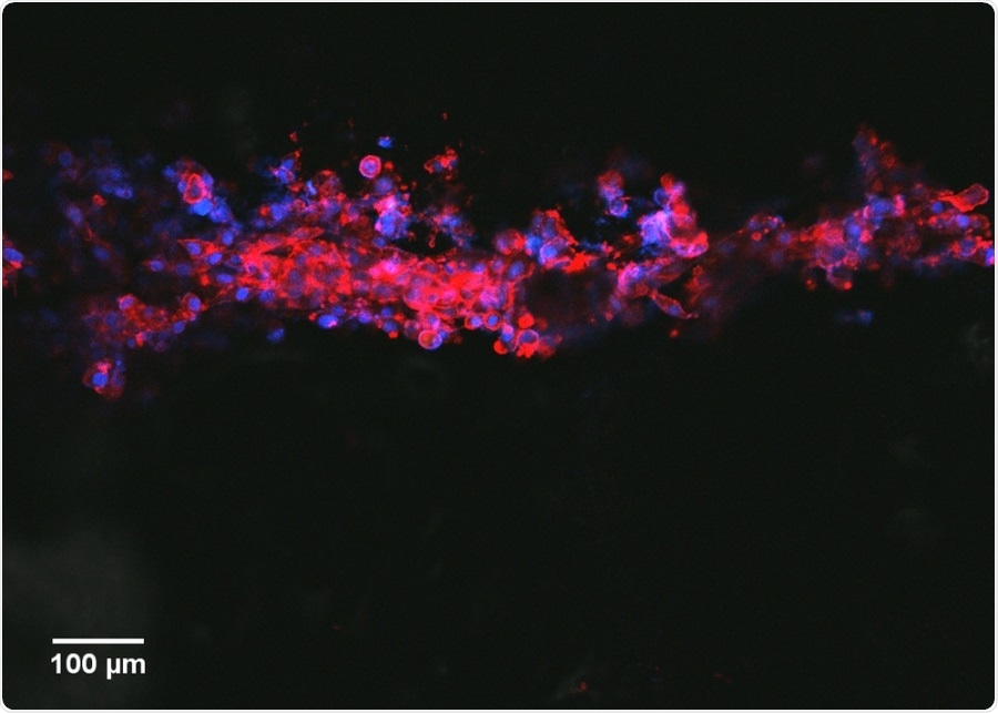 Bioconductive, neuron-growing ink offers hope for people with nerve injury