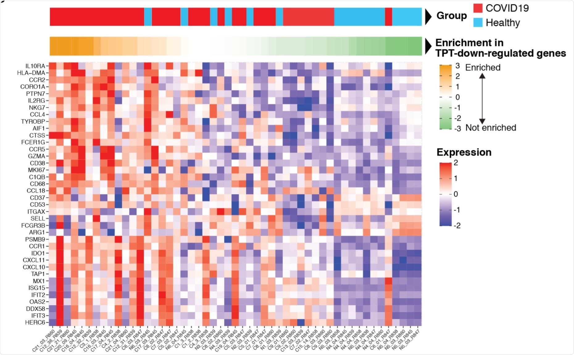Expression in lung autopsy tissue of COVID19 patients and healthy controls