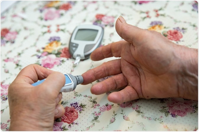 The research shows paradoxical trends in overtreatment and undertreatment of patients with Type 2 diabetes. Image Credit: urbans / Shutterstock