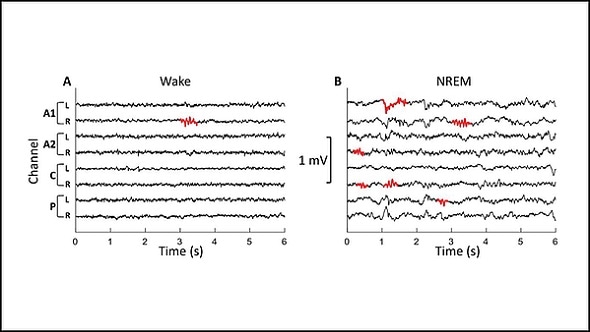 Sleep spindles in sheep could provide clues to human brain disorders