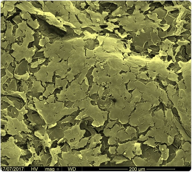 Scanning electron microscopy image depicting endothelial cells growing on the surface of the printed tubular structures. Image Credit: Professor Alvaro Mata