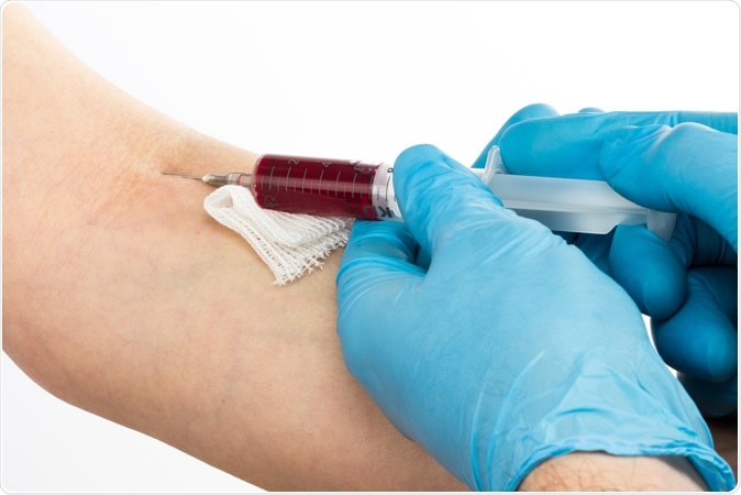 Detecting cancer at its earliest stages from a simple blood draw is the goal of several companies currently developing