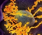 As the coronavirus spreads, Americans lose ground against other health threats