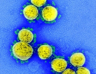 UK walks back from ‘herd immunity' plan