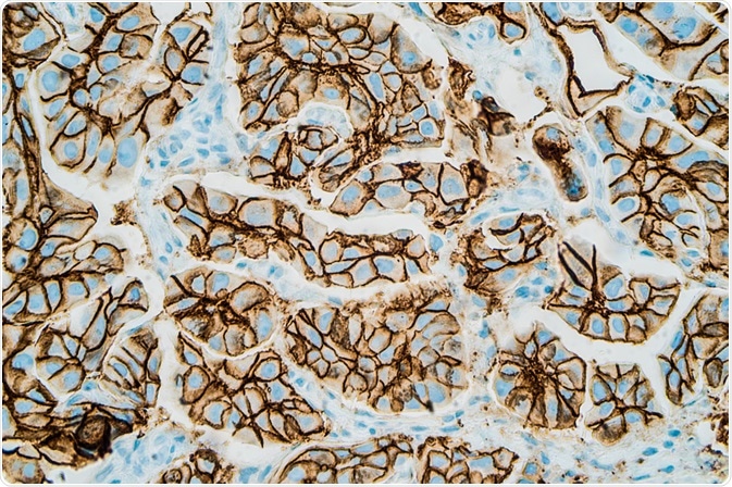 Immunohistochemistry Test