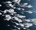 Key protein in sperm production could aid male infertility treatments
