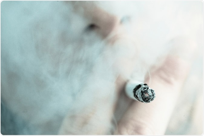 Study: Smoking is Associated with COVID-19 Progression: A Meta-Analysis. Image Credit: Wavebreakmedia / Shutterstock