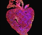 Potential cure for heart disease via cancer gene upregulation