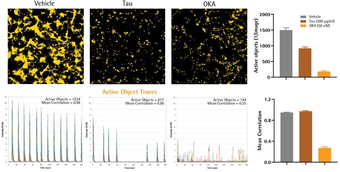 Neuronal and Microglial Analysis for Alzheimer’s Disease Models