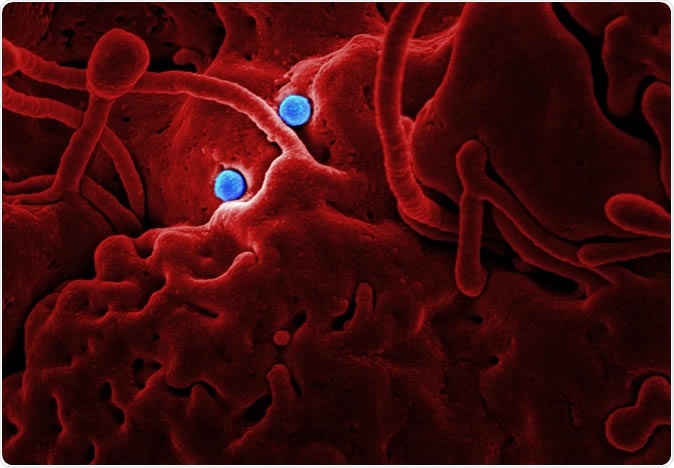 MERS Coronavirus Particles MERS-CoV particles on camel epithelial cells. Credit: NIAID in collaboration with Colorado State University