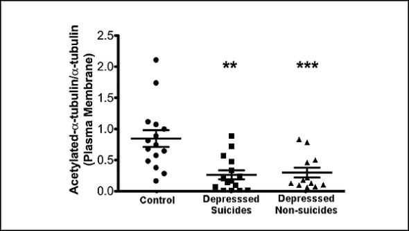 Structural protein may be new target for diagnosis, treatment of depression