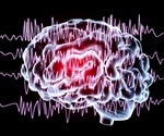Treating Epilepsy with Stimulated Seizures