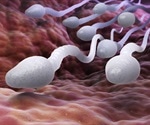 Faulty Sperm and Frequent Miscarriages