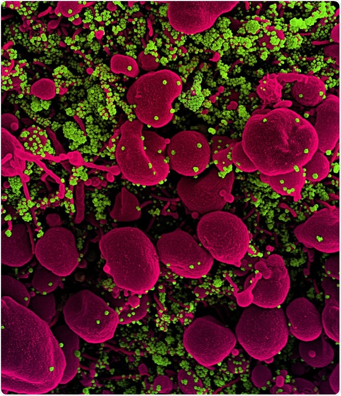 Novel Coronavirus SARS-CoV-2 Colorized scanning electron micrograph of an apoptotic cell (pink) heavily infected with SARS-COV-2 virus particles (green), isolated from a patient sample. Image captured at the NIAID Integrated Research Facility (IRF) in Fort Detrick, Maryland. Credit: NIAID