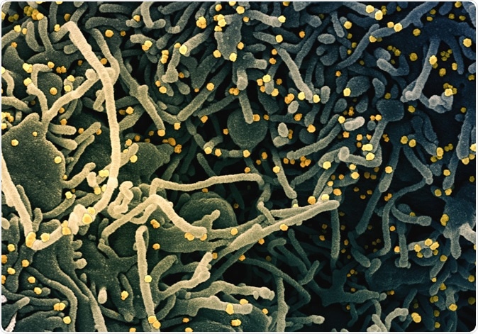 Novel Coronavirus SARS-CoV-2 Colorized scanning electron micrograph of a VERO E6 cell (blue-green) exhibiting elongated cell projections and signs of apoptosis, after infection with SARS-COV-2 virus particles (yellow), which were isolated from a patient sample. Image captured at the NIAID Integrated Research Facility (IRF) in Fort Detrick, Maryland. Credit: NIAID