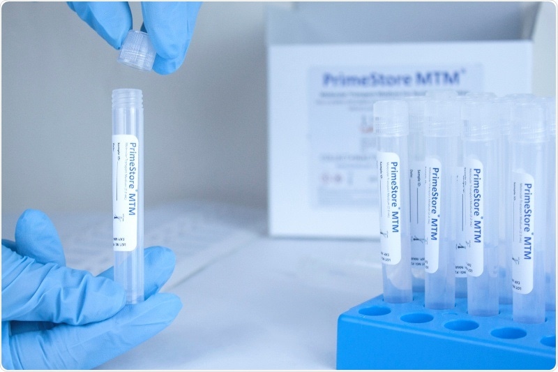 EKF secures COVID-19 novel sample collection kit manufacturing and supply contracts