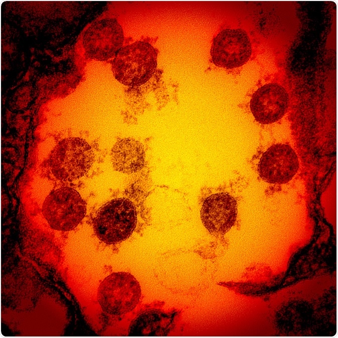 Novel Coronavirus SARS-CoV-2 Transmission electron micrograph of SARS-CoV-2 virus particles, isolated from a patient. Image captured and color-enhanced at the NIAID Integrated Research Facility (IRF) in Fort Detrick, Maryland. Credit: NIAID