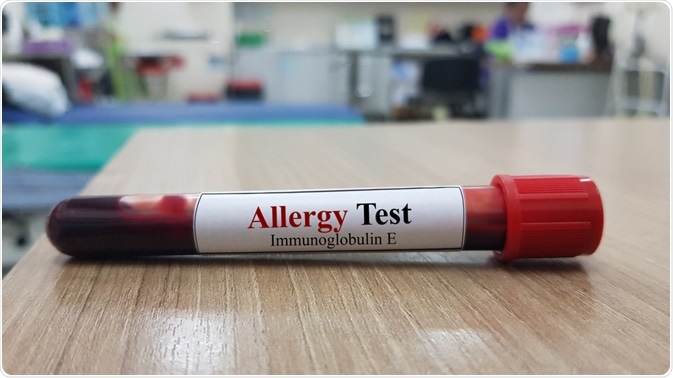 IgE Allergy Test