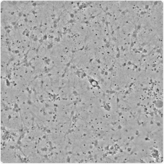 Primary neuronal cells in a single well of a 1536 well Aurora microplate.