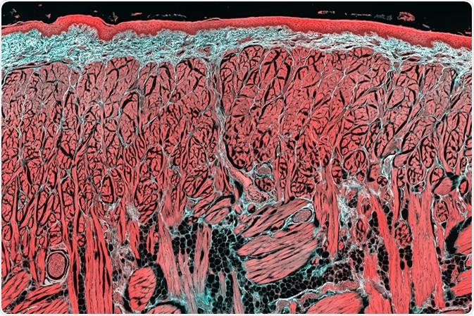 muscle tissue