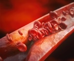 Scientists develop peptides that restore balance in gut bacteria and reverse atherosclerosis