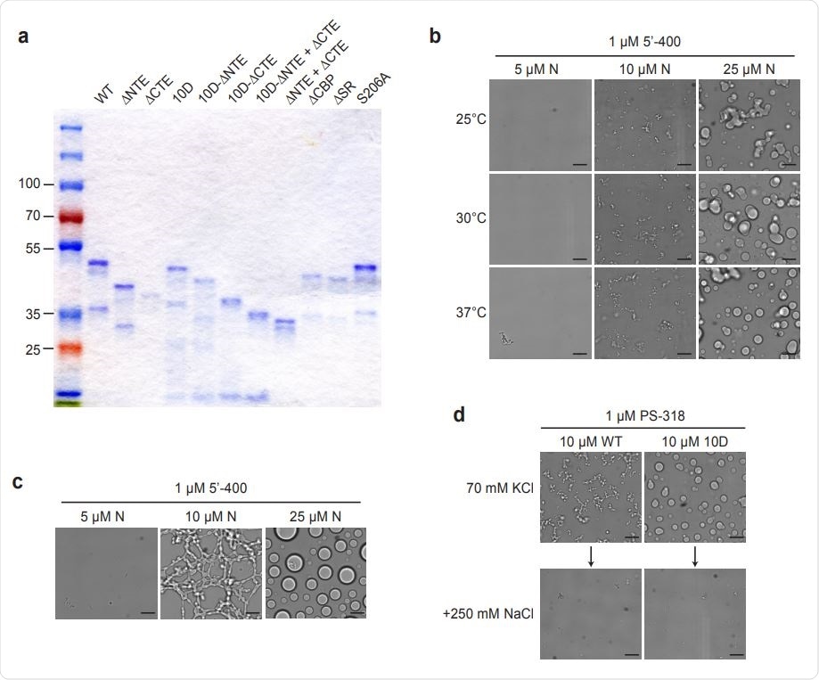 Characterization of N protein condensates. a, SDS-PAGE analysis of all N protein mutants used in this study, stained with Coomassie Blue. b, N protein was incubated at the indicated temperature for 30 min in the presence of 1 µM 5’-400 RNA. Scale bar, 10 µm. c, N protein was incubated with 1 µM 5’-400 for 16 h at room temperature. Scale bar, 10 µm. d, Condensates of 10 µM WT or 10D N protein were formed in droplet buffer (70 mM KCl) by incubation with 1 µM PS-318 RNA for 30 min and imaged. NaCl was then added to a final concentration of 250 mM for 15 min before imaging again.