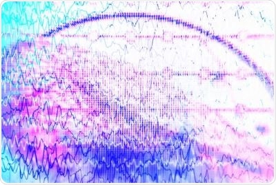 Psychogenic non-epileptic seizures are often misdiagnosed as epilepsy and increase risk of death Psychogenic non-epileptic seizures are often misdiagnosed as epilepsy and increase risk of death