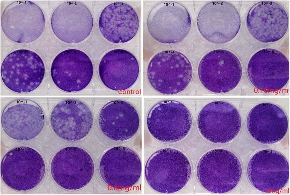 Human breastmilk inhibited infectious virus production. The virus titers of supernatant of control and different concentration of human breastmilk treatment were determined by plaque assay. MOI, multiplicity of infection; RT-qPCR, Real time quantitative polymerase chain reaction. Values are shown as mean of triplicates ± SD, **p<0.01, ***p<0.001 by unpaired two-tailed t test.