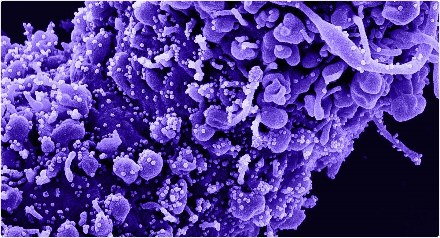 Severe acute respiratory syndrome coronavirus 2 (SARS-CoV-2) particles.