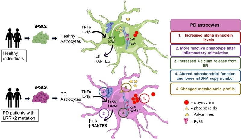 Study links brain astrocyte dysfunction to Parkinson’s disease pathology