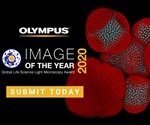 The art of science: Olympus launches second global image of the year award