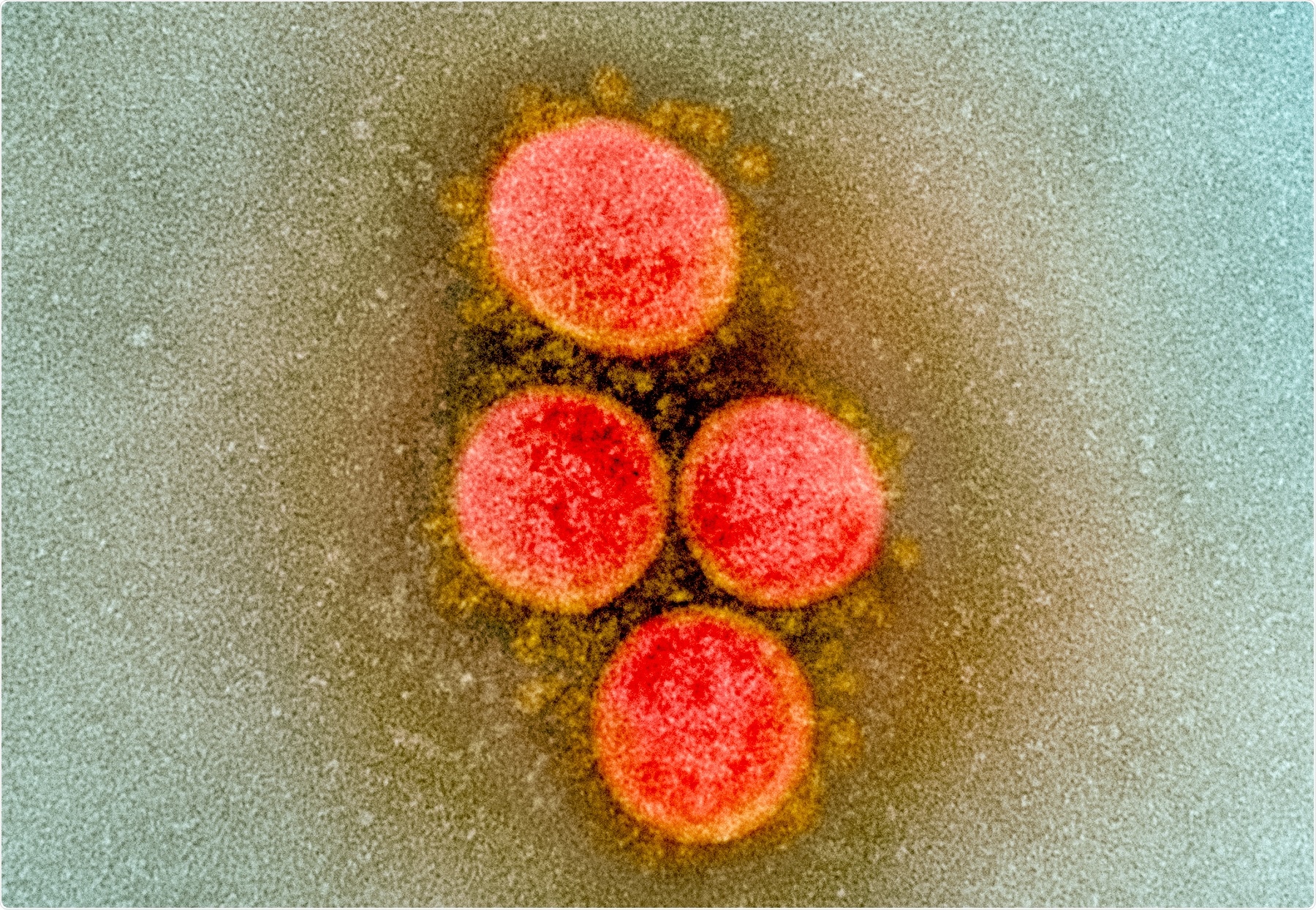 Study: Trajectories of Hypoxemia & Respiratory System Mechanics of COVID-19 ARDS in the NorthCARDS dataset. Image Credit: NIAID