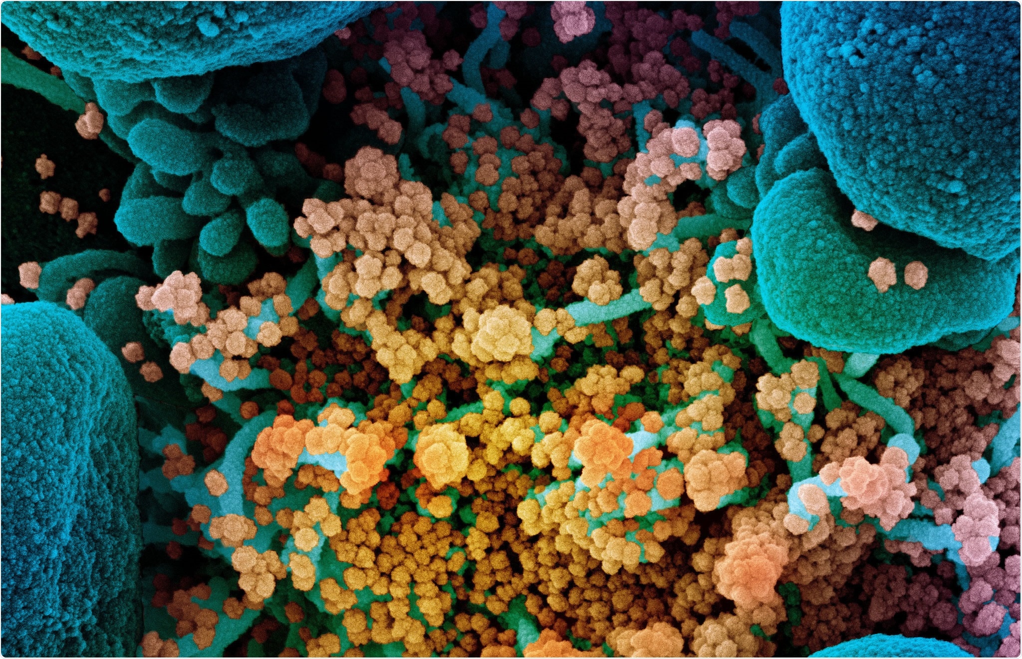 Study: SARS-CoV-2 spike protein arrested in the closed state induces potent neutralizing responses. Image Credit: NIAID
