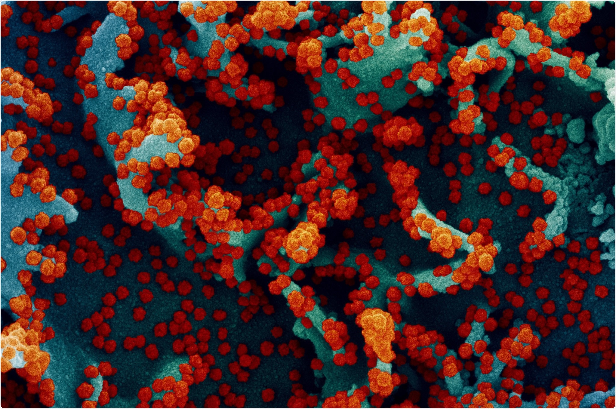 Study: Impact of SARS-CoV-2 B.1.1.7 Spike variant on neutralisation potency of sera from individuals vaccinated with Pfizer vaccine BNT162b2. Image Credit: NIAID